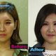 Image for article titled Depressing? Inspirational? Reverse Plastic Surgery Show Hits Korea